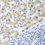 Immunohistochemistry - Anti-SHBG Antibody (A12120) - Antibodies.com
