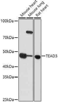 Western blot analysis of extracts of various cell lines, using Anti-TEAD3 Antibody (A7454) at 1:1,000 dilution.
Secondary antibody: Goat Anti-Rabbit IgG (H+L) (HRP) (AS014) at 1:10,000 dilution.
Lysates / proteins: 25µg per lane.
Blocking buffer: 3% non-fat dry milk in TBST.
Detection: ECL Basic Kit (RM00020).
Exposure time: 90s.
