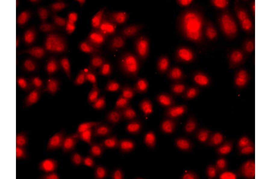 Immunofluorescence - Anti-TEAD3 Antibody (A12121) - Antibodies.com