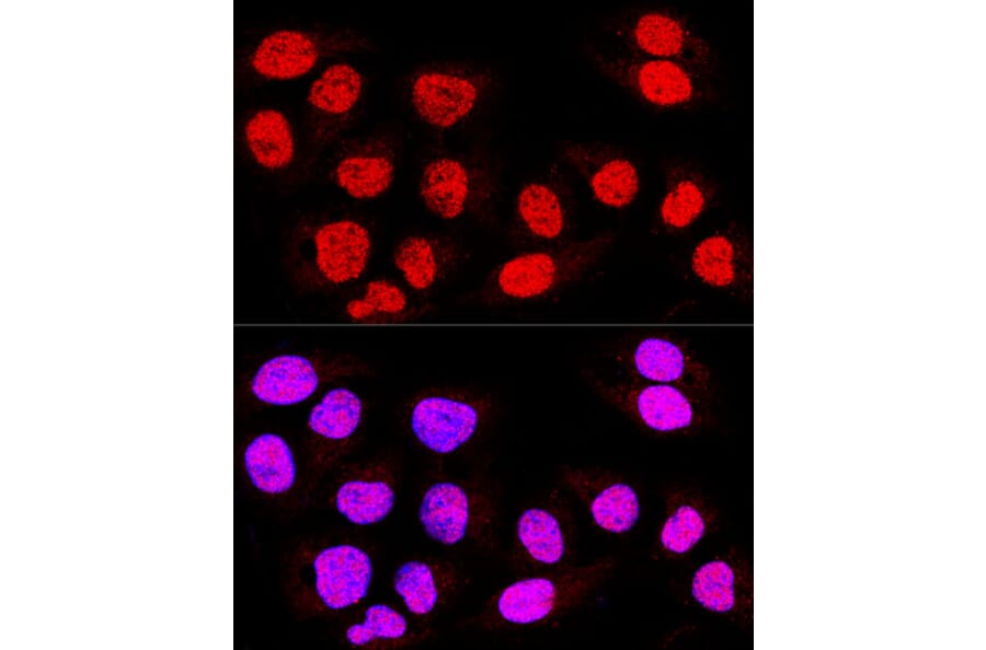 Immunofluorescence - Anti-TEAD3 Antibody (A12121) - Antibodies.com