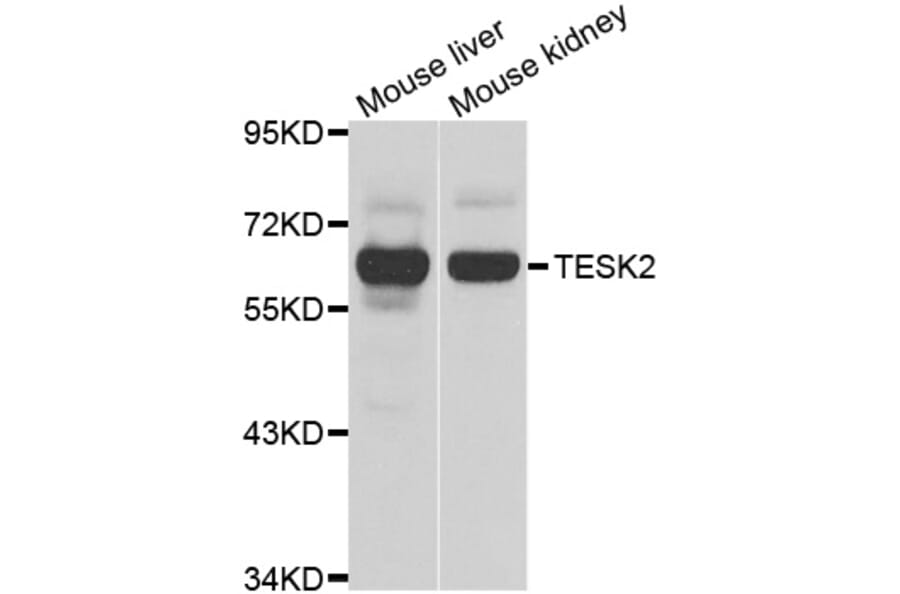 Western Blot - Anti-TESK2 Antibody (A7460) - Antibodies.com