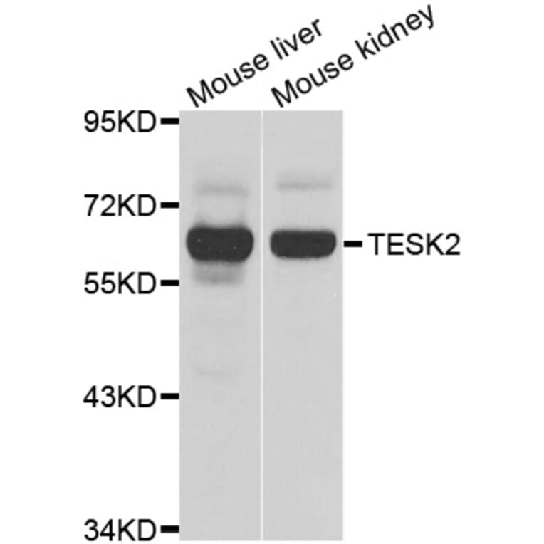 Western Blot - Anti-TESK2 Antibody (A7460) - Antibodies.com