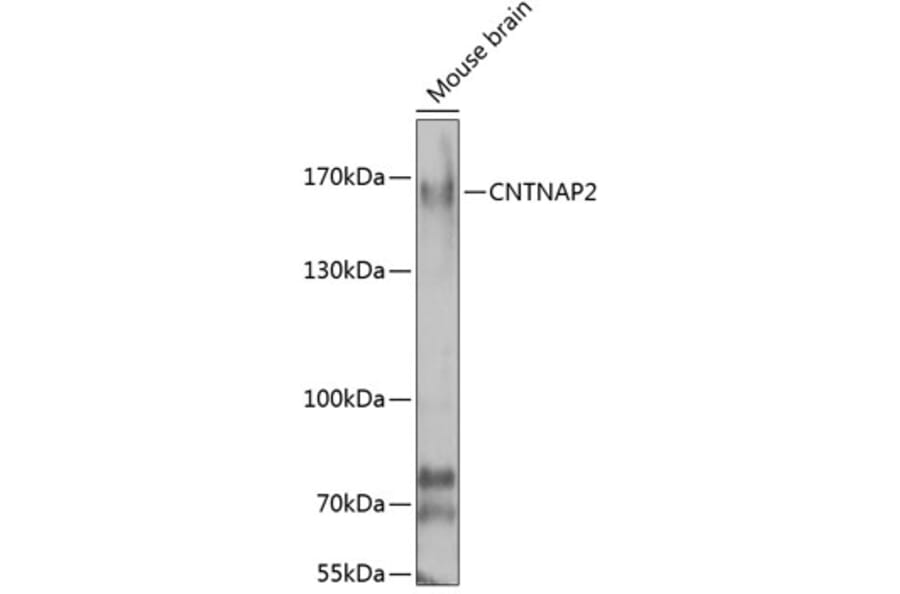 Western Blot - Anti-CNTNAP2 Antibody (A7466) - Antibodies.com