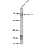 Western Blot - Anti-CNTNAP2 Antibody (A7466) - Antibodies.com