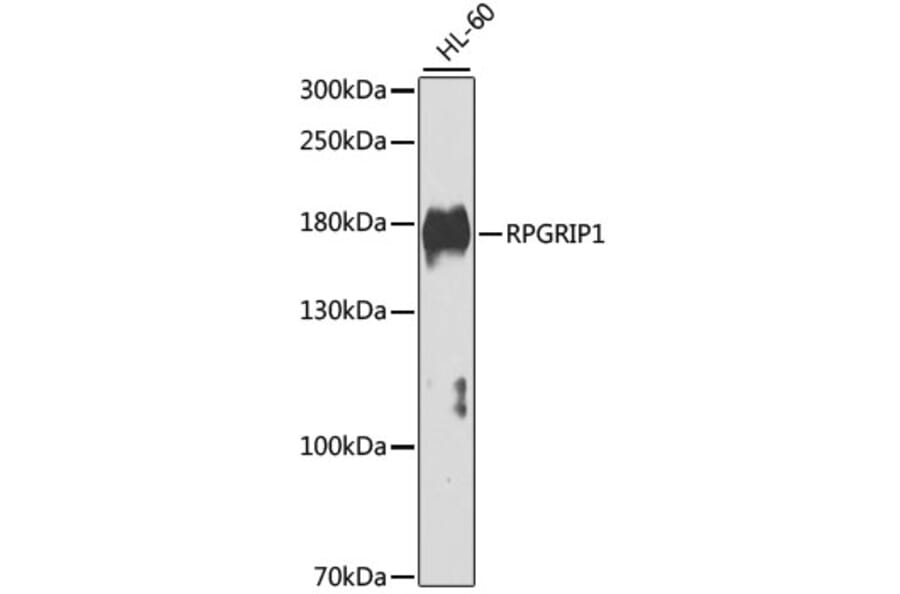 Western Blot - Anti-RPGRIP1 Antibody (A7477) - Antibodies.com