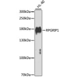 Western Blot - Anti-RPGRIP1 Antibody (A7477) - Antibodies.com