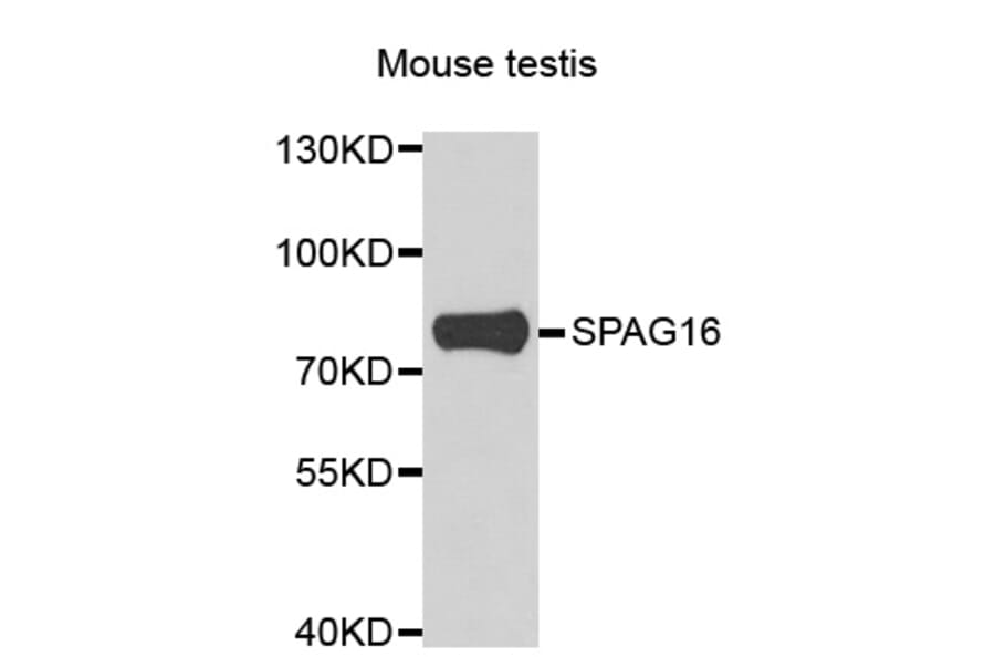 Western Blot - Anti-SPAG16 Antibody (A7482) - Antibodies.com