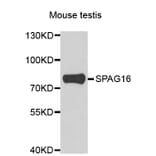 Western Blot - Anti-SPAG16 Antibody (A7482) - Antibodies.com