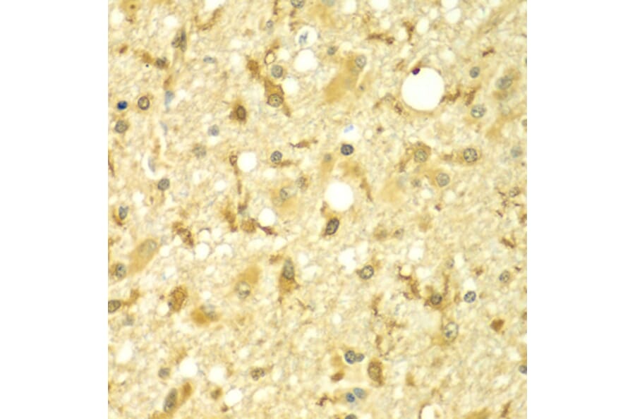 Immunohistochemistry - Anti-SPAG16 Antibody (A7482) - Antibodies.com