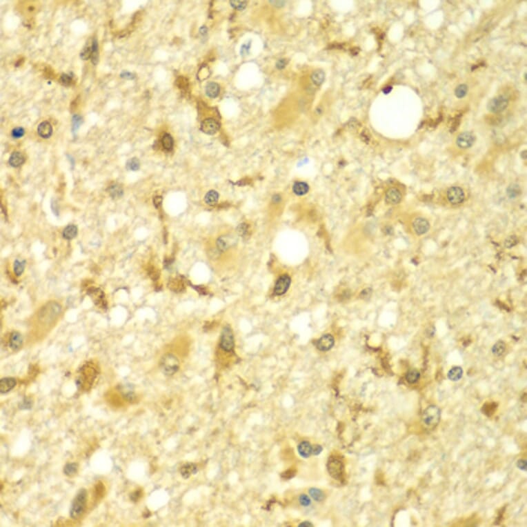 Immunohistochemistry - Anti-SPAG16 Antibody (A7482) - Antibodies.com