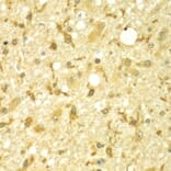 Immunohistochemistry - Anti-SPAG16 Antibody (A7482) - Antibodies.com
