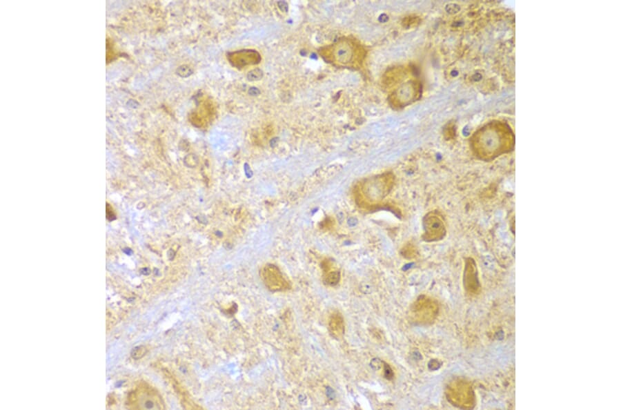 Immunohistochemistry - Anti-SPAG16 Antibody (A7482) - Antibodies.com