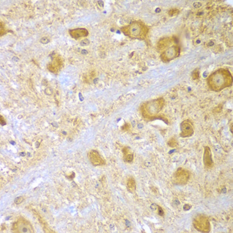 Immunohistochemistry - Anti-SPAG16 Antibody (A7482) - Antibodies.com