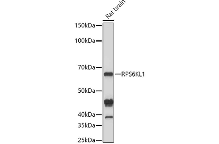 Western Blot - Anti-RPS6KL1 Antibody (A12126) - Antibodies.com