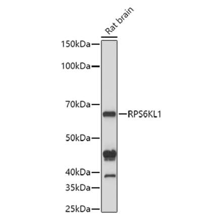 Western Blot - Anti-RPS6KL1 Antibody (A12126) - Antibodies.com