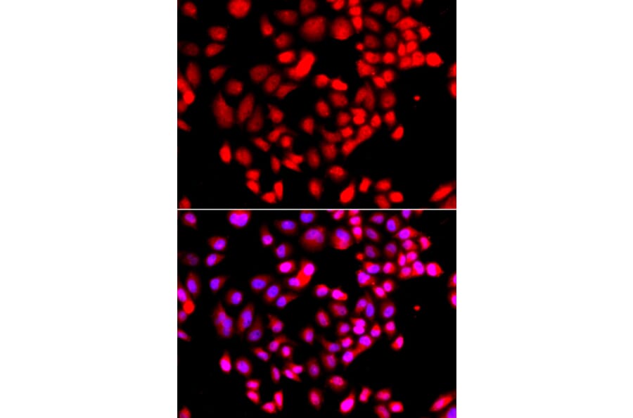 Immunofluorescence - Anti-RPS6KL1 Antibody (A12126) - Antibodies.com