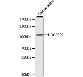 Western Blot - Anti-HDGFRP2 Antibody (A7484) - Antibodies.com