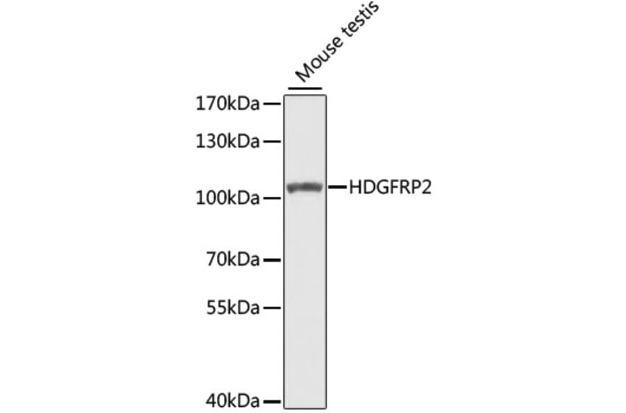 Western Blot - Anti-HDGFRP2 Antibody (A7484) - Antibodies.com