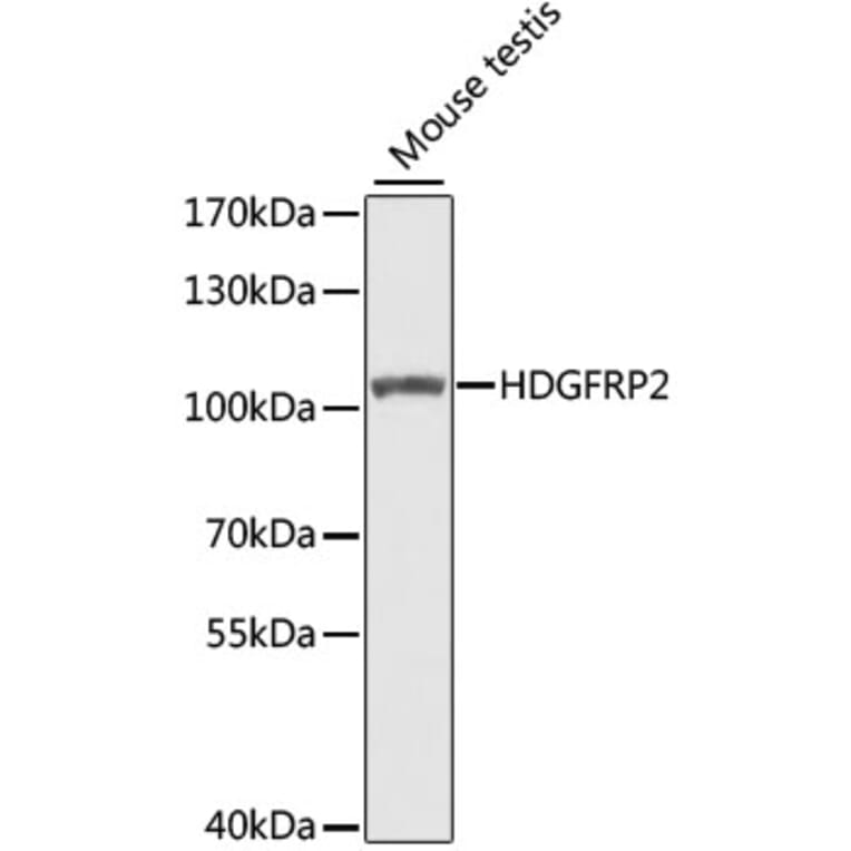 Western Blot - Anti-HDGFRP2 Antibody (A7484) - Antibodies.com