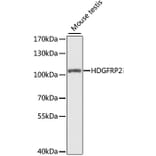 Western Blot - Anti-HDGFRP2 Antibody (A7484) - Antibodies.com