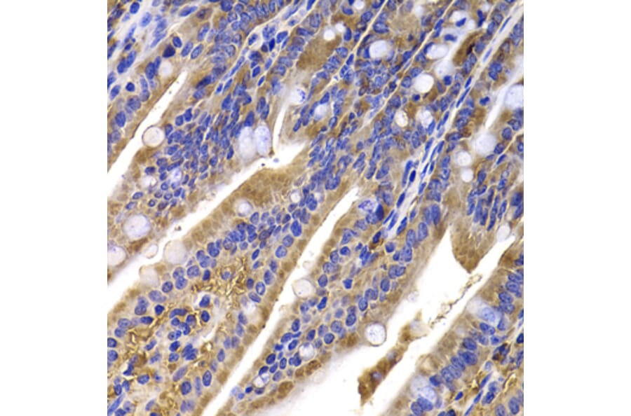 Immunohistochemistry - Anti-HDGFRP2 Antibody (A7484) - Antibodies.com