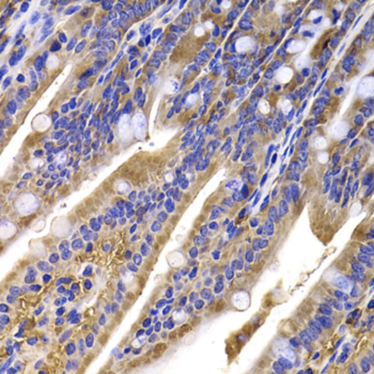 Immunohistochemistry - Anti-HDGFRP2 Antibody (A7484) - Antibodies.com