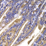 Immunohistochemistry - Anti-HDGFRP2 Antibody (A7484) - Antibodies.com