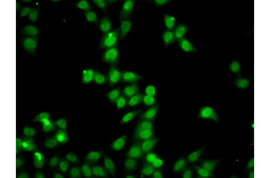 Immunofluorescence - Anti-HDGFRP2 Antibody (A7484) - Antibodies.com