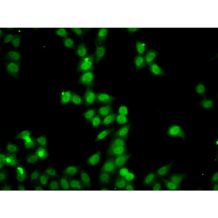 Immunofluorescence - Anti-HDGFRP2 Antibody (A7484) - Antibodies.com