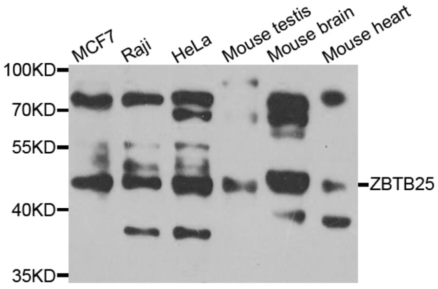 Western Blot - Anti-ZBTB25 Antibody (A7501) - Antibodies.com