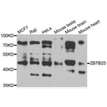 Western Blot - Anti-ZBTB25 Antibody (A7501) - Antibodies.com