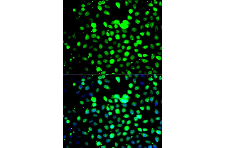 Immunofluorescence - Anti-ZBTB25 Antibody (A7501) - Antibodies.com