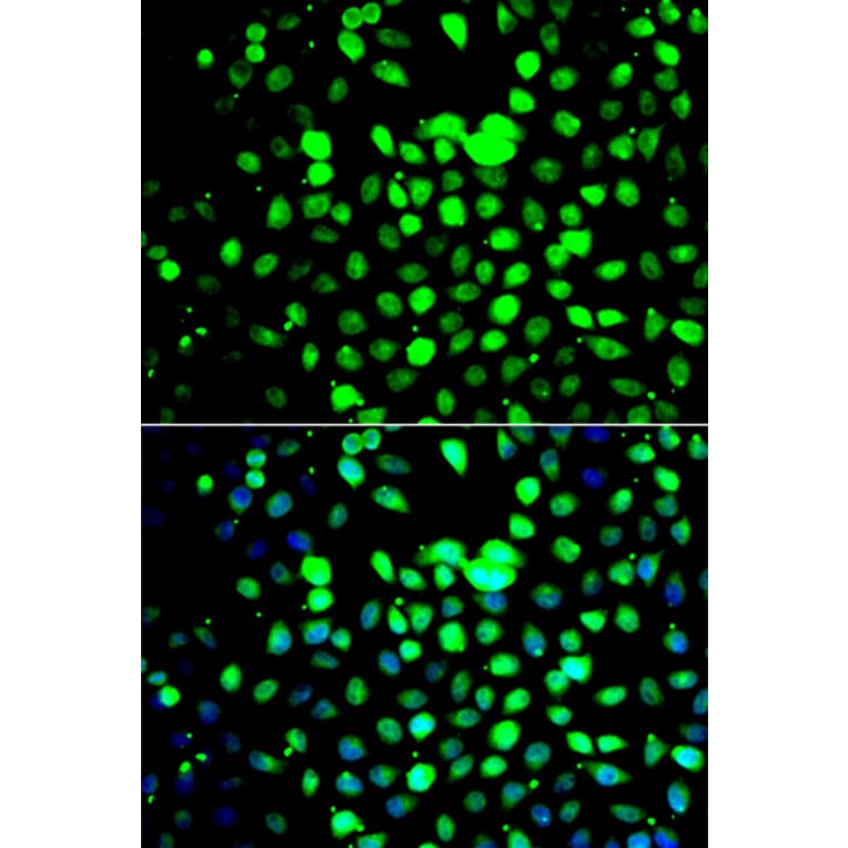 Immunofluorescence - Anti-ZBTB25 Antibody (A7501) - Antibodies.com