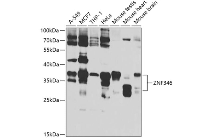 Western Blot - Anti-ZNF346 Antibody (A12130) - Antibodies.com