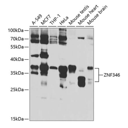 Western Blot - Anti-ZNF346 Antibody (A12130) - Antibodies.com