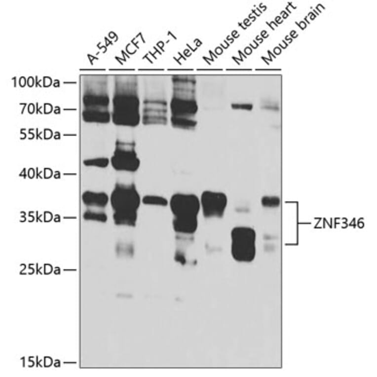 Western Blot - Anti-ZNF346 Antibody (A12130) - Antibodies.com