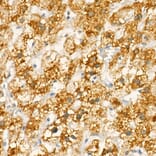 Immunohistochemistry - Anti-MTCO1 Antibody (A12131) - Antibodies.com
