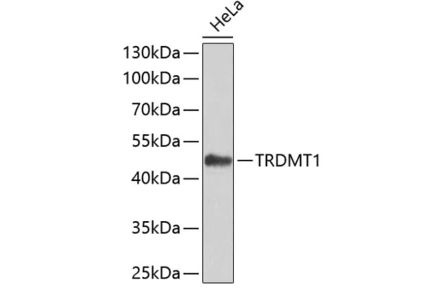 Western Blot - Anti-TRDMT1 Antibody (A7540) - Antibodies.com