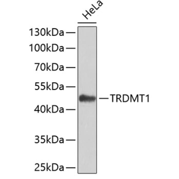 Western Blot - Anti-TRDMT1 Antibody (A7540) - Antibodies.com