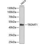 Western Blot - Anti-TRDMT1 Antibody (A7540) - Antibodies.com