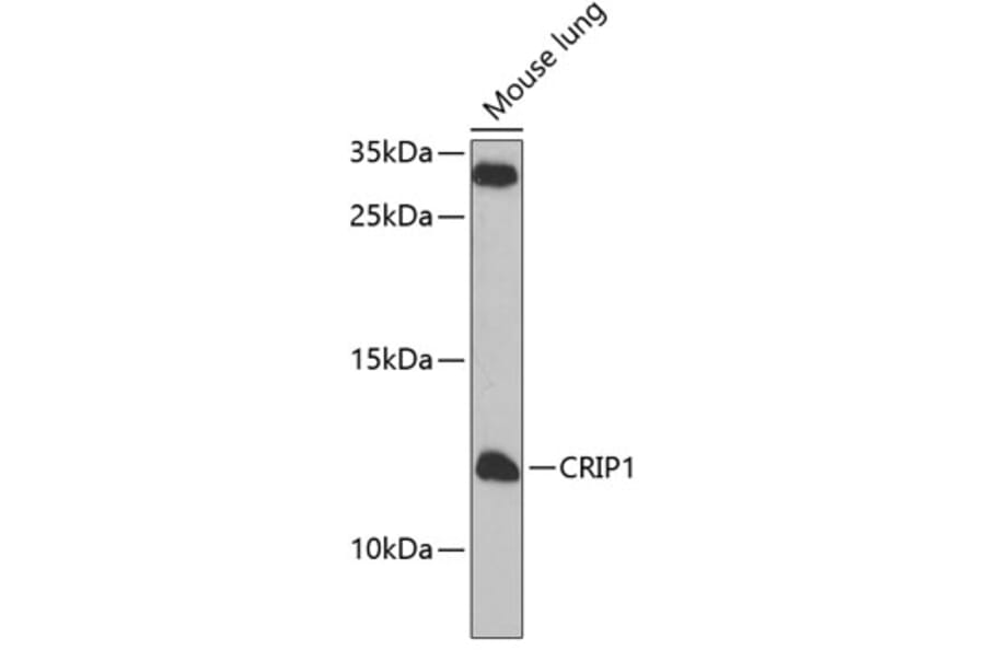 Western Blot - Anti-CRP-1 Antibody (A12133) - Antibodies.com