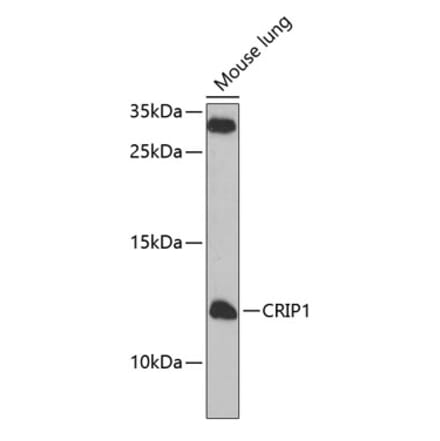 Western Blot - Anti-CRP-1 Antibody (A12133) - Antibodies.com