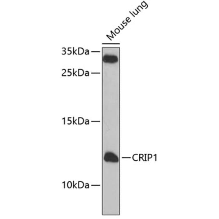 Western Blot - Anti-CRP-1 Antibody (A12133) - Antibodies.com