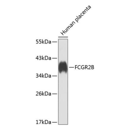 Western Blot - Anti-FCGR2B Antibody (A12134) - Antibodies.com
