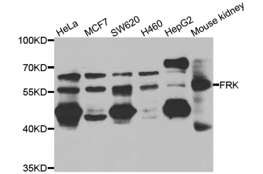 Western Blot - Anti-FRK Antibody (A7556) - Antibodies.com