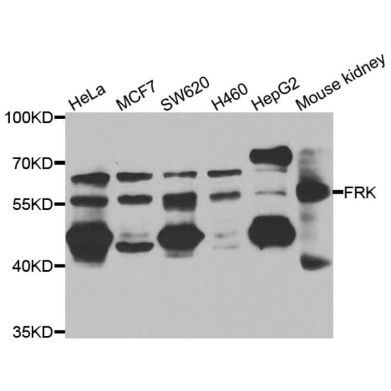 Western Blot - Anti-FRK Antibody (A7556) - Antibodies.com