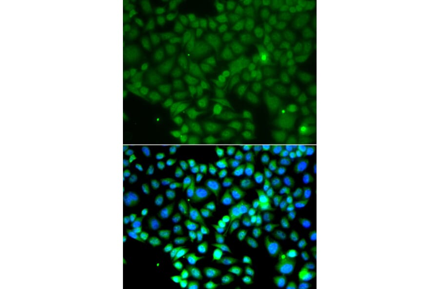 Immunofluorescence - Anti-FRK Antibody (A7556) - Antibodies.com
