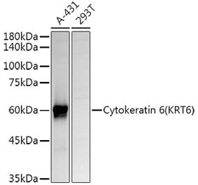 Western Blot - Anti-Cytokeratin 6a Antibody (A12136) - Antibodies.com
