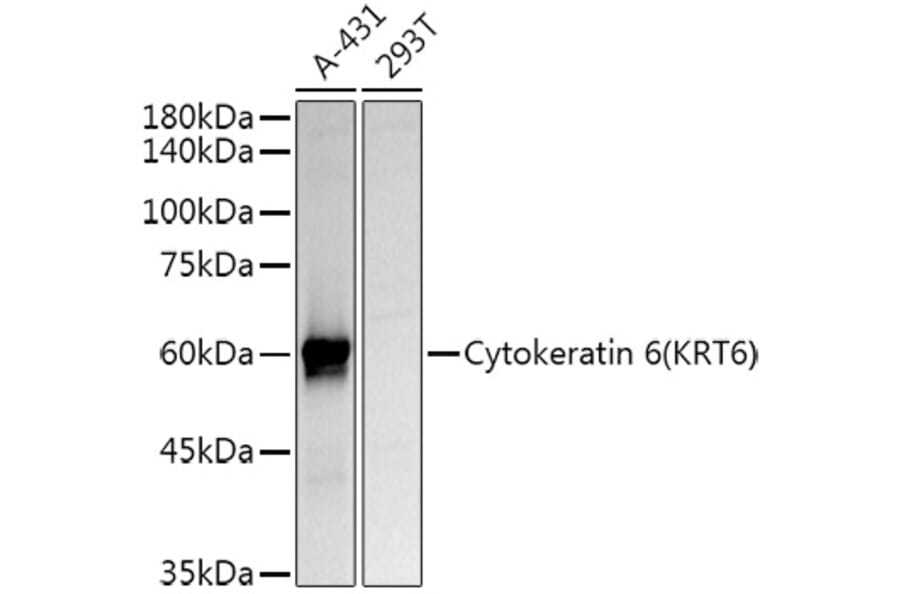 Western Blot - Anti-Cytokeratin 6a Antibody (A12136) - Antibodies.com