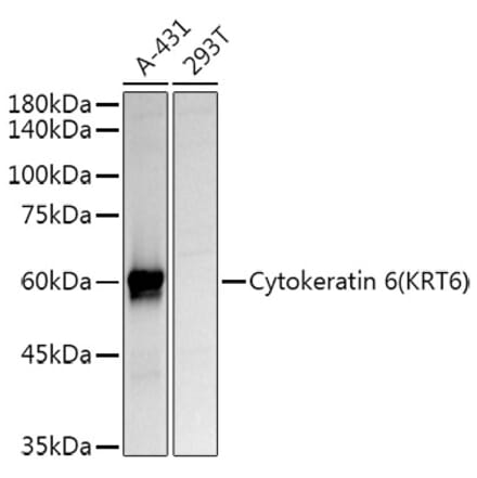Western Blot - Anti-Cytokeratin 6a Antibody (A12136) - Antibodies.com